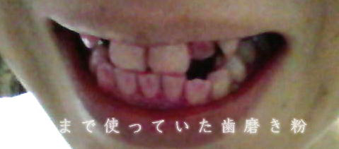 今まで使っていた歯磨き粉でのブラシ後