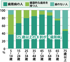 25歳以上の8割が「歯周病」